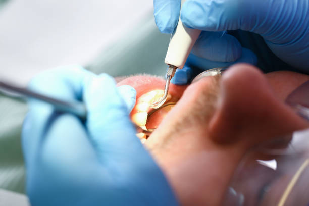 Best Cosmetic Emergency Dentistry in Gluckstadt, MS