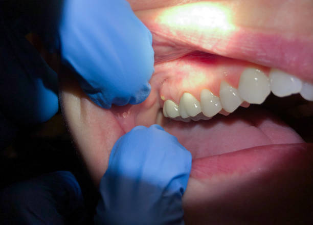 Best Emergency Orthodontic Services in Gluckstadt, MS